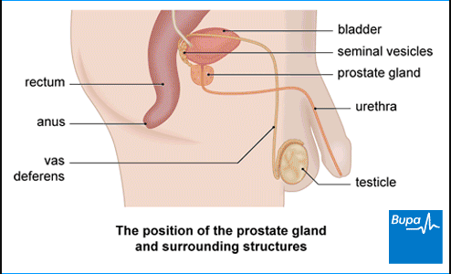 Prostate Problems